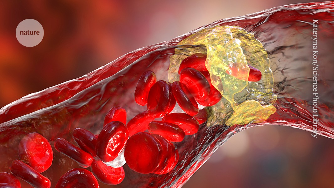 Salud: Una molécula intestinal reduce placas arteriales en ratones
