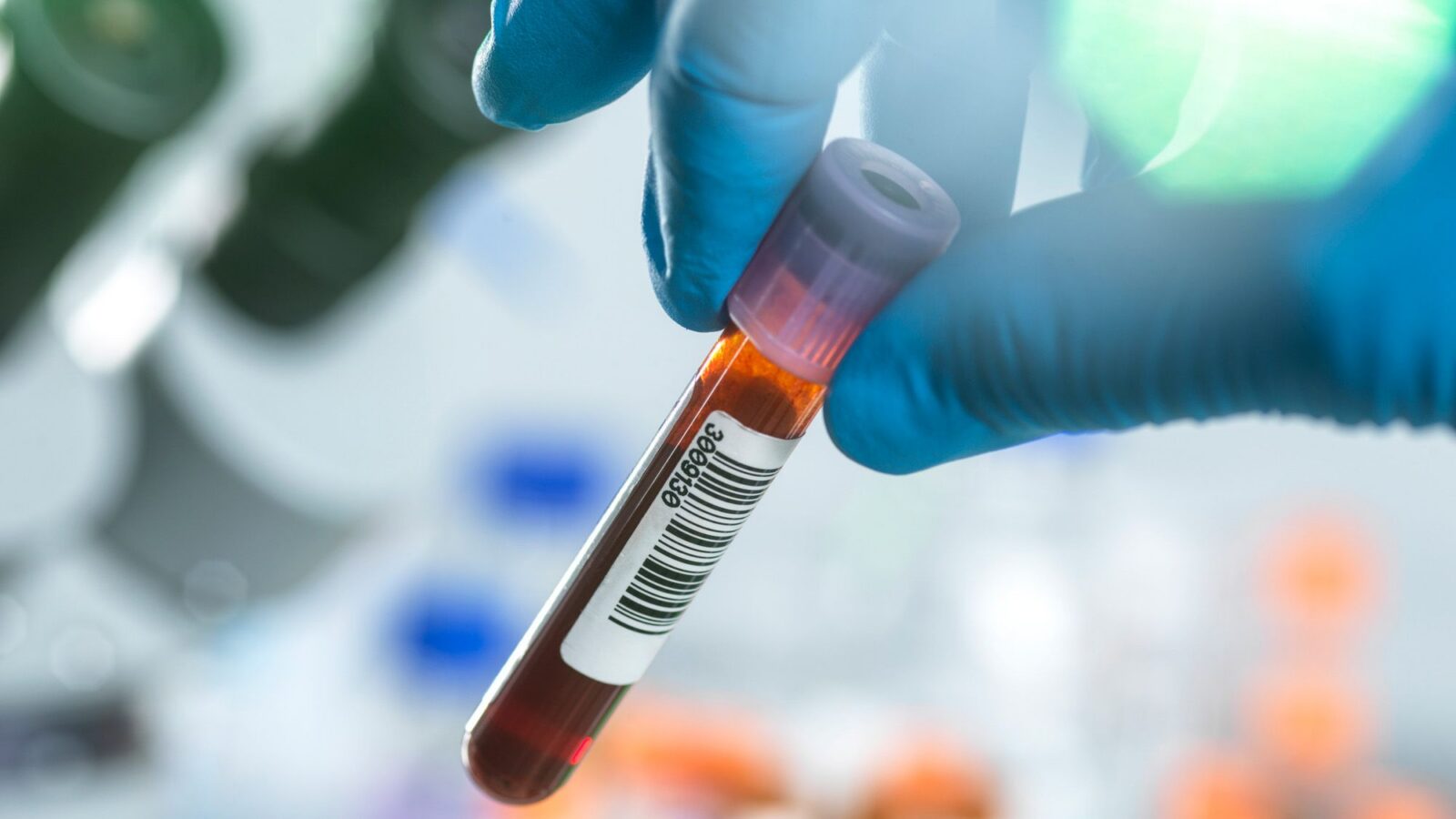 Salud: Proteínas en sangre ofrecen pistas sobre cómo envejecemos
