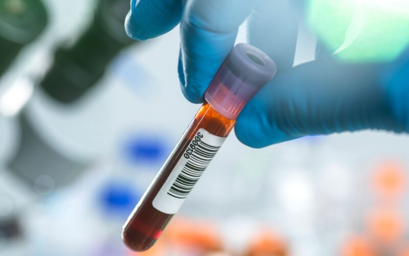 Salud: Proteínas en sangre ofrecen pistas sobre cómo envejecemos