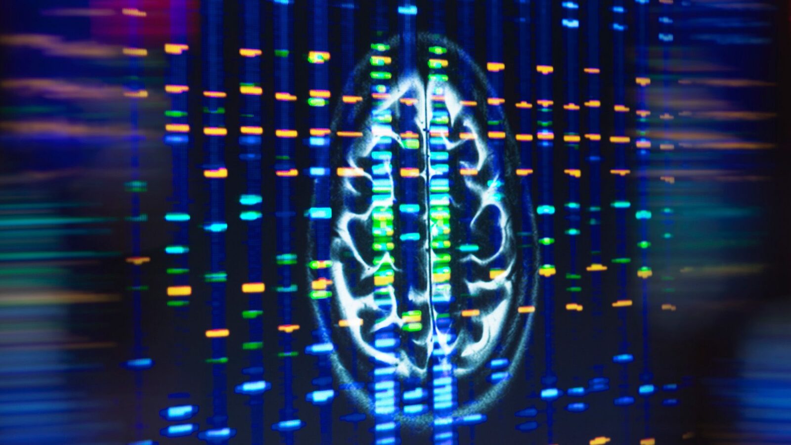 Salud: Una pista sobre APOE4 y la grasa cerebral