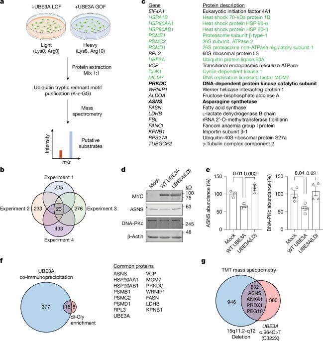 Neurociencia: Reducir ASNS mejora rasgos de Angelman en ratones