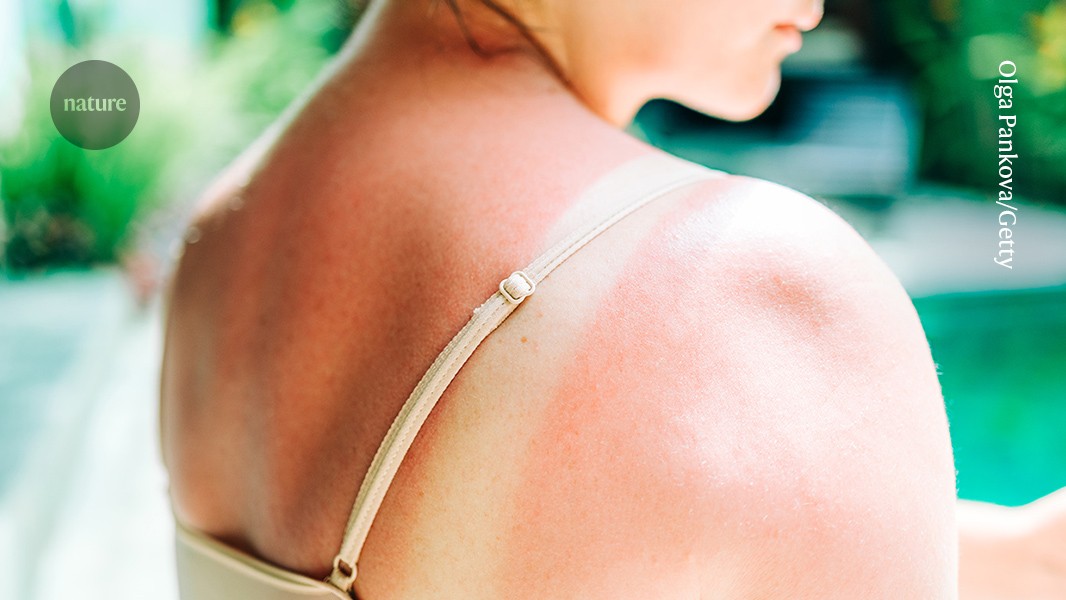 Salud: Vacuna de ARNm reduce recaídas del melanoma o muertes