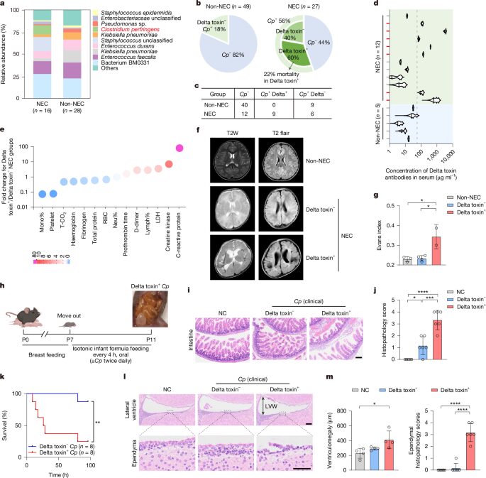 Salud: Una toxina vincula daño intestinal y cerebral