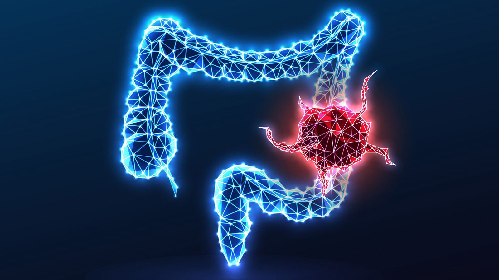 Salud: Pistas sobre el cáncer colorrectal en jóvenes